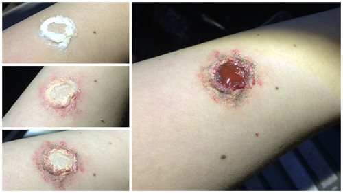 Fake Wound