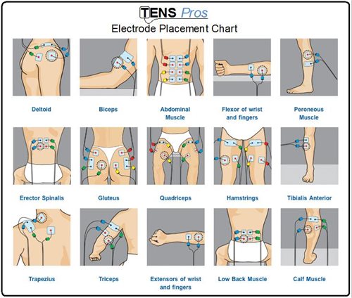 TENS