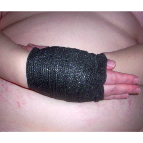 Mind the belly stretch marks