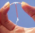 My Experience With the IUD and How it Improved My Life