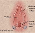 Bartholin Gland cyst or abscess, i.e. The Newlyweds or Honeymoon Disease