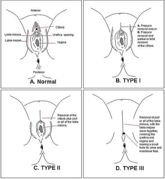 FGM Types