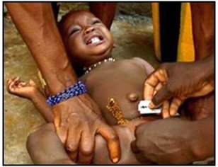 A Child Undergoes FGM