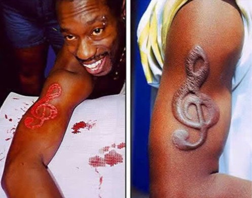 scarification